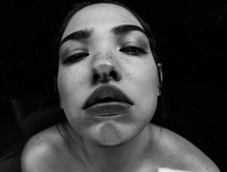 Aumento de labios